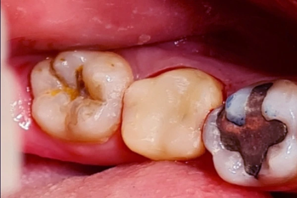 restauracija-poslije